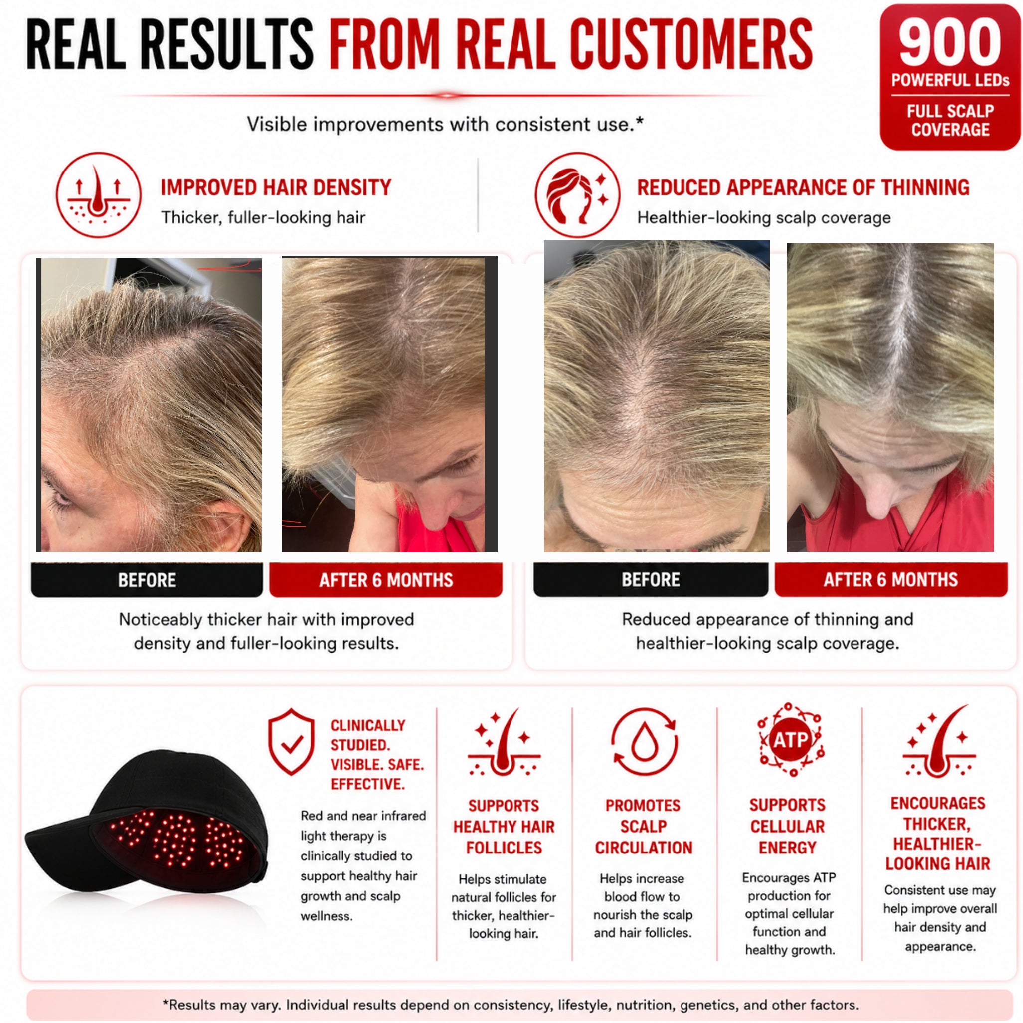 Red Light Pro Devices | Red Light Therapy Full Scalp Hat