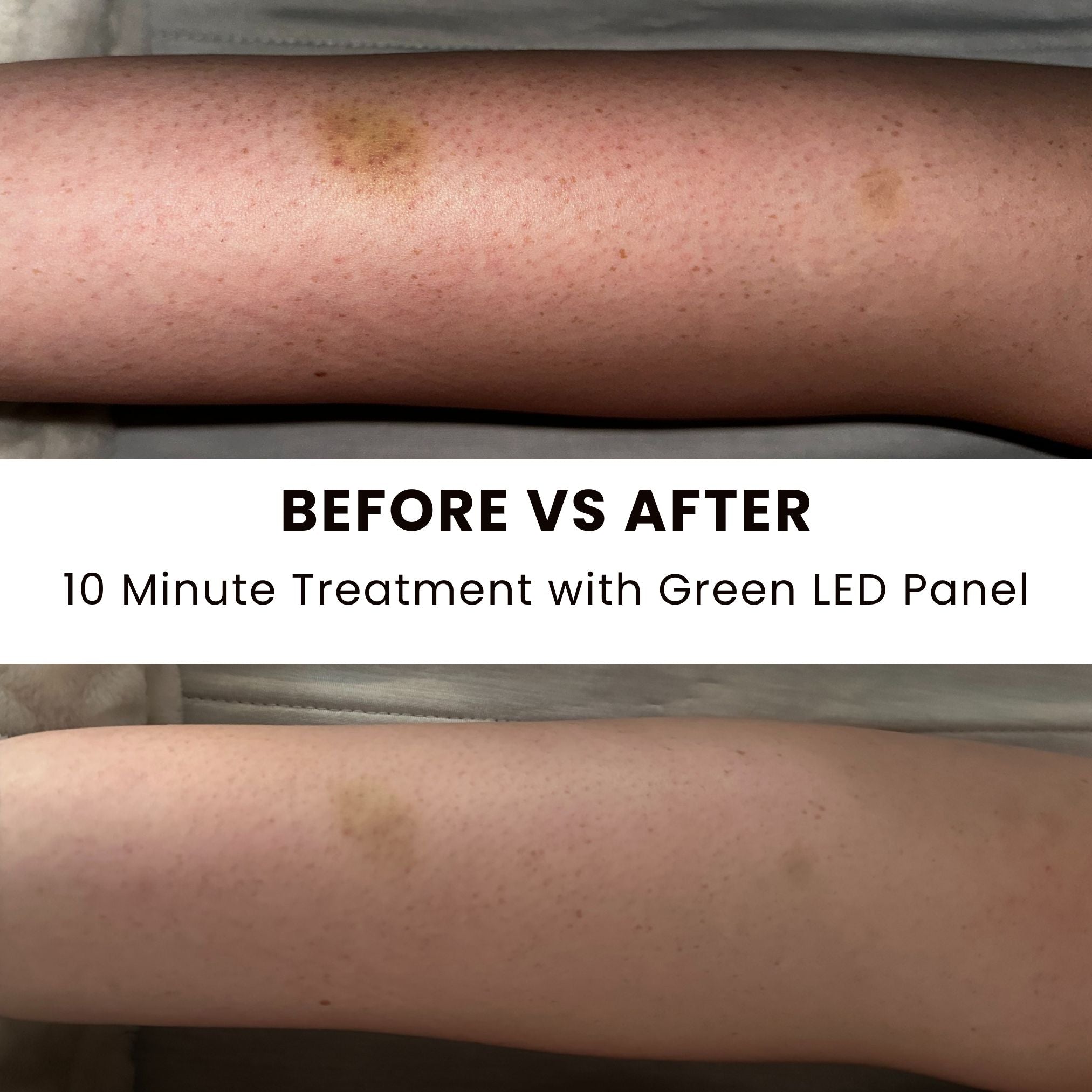 Lumara | Illuminate Green Light Therapy Panel